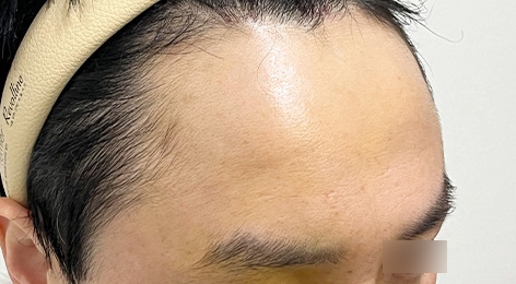 시술전사진