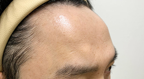 시술전사진