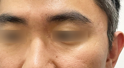 시술전사진