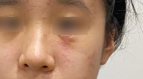시술전사진