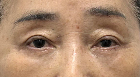 시술전사진