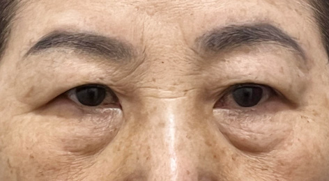 시술전사진