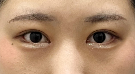 시술전사진