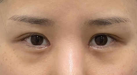 시술전사진