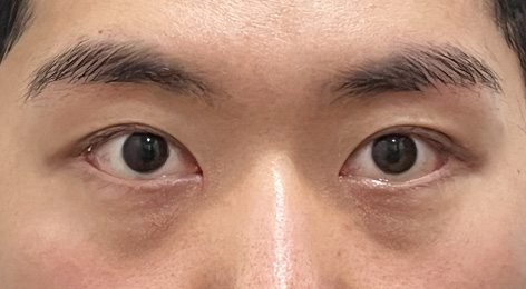 시술전사진