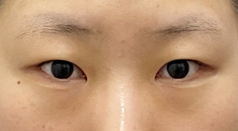 시술전사진