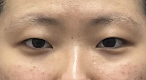 시술전사진