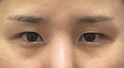 시술전사진