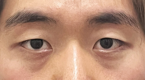 시술전사진