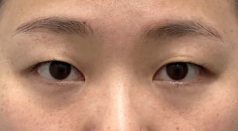 시술전사진