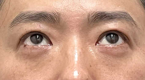 시술전사진