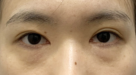 시술전사진