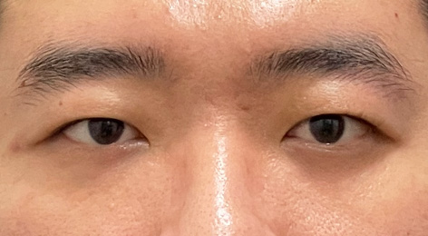 시술전사진