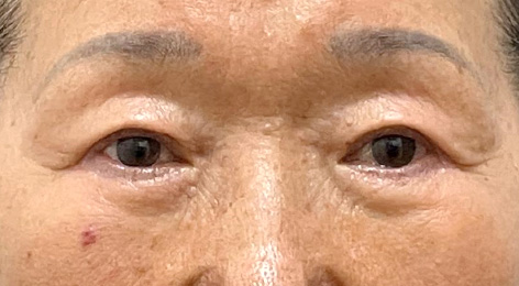 시술전사진
