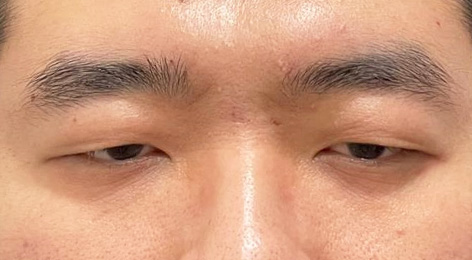 시술전사진