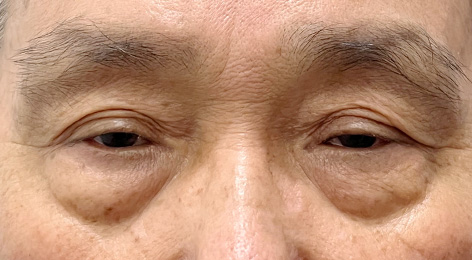 시술전사진