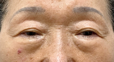 시술전사진