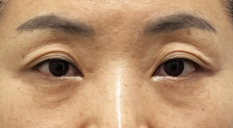 시술전사진
