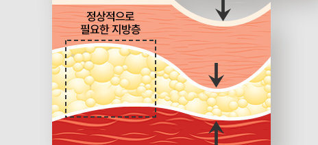 사진이미지
