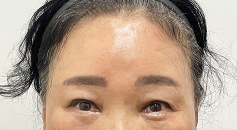 시술전사진