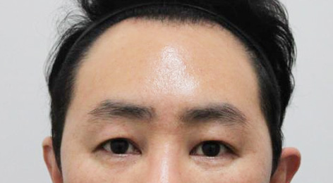 시술전사진