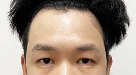 시술전사진