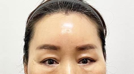 시술전사진