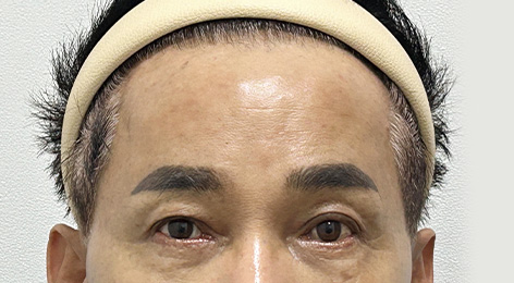 시술전사진
