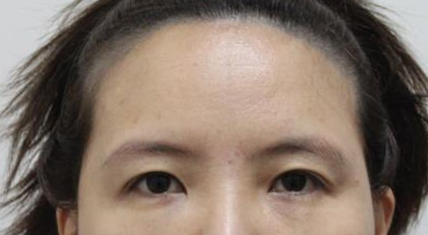 시술전사진