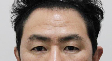 시술전사진