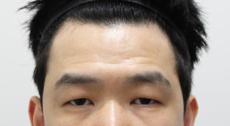 시술전사진