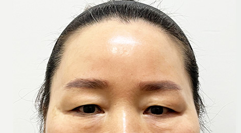 시술전사진