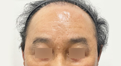시술전사진