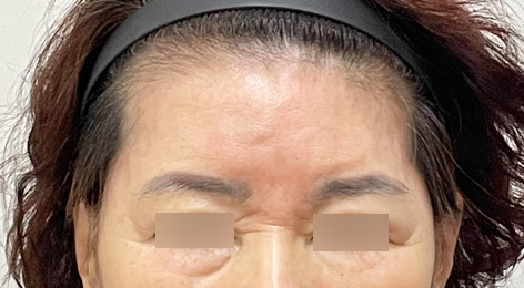 시술전사진