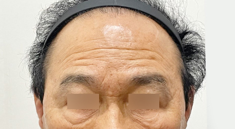 시술전사진